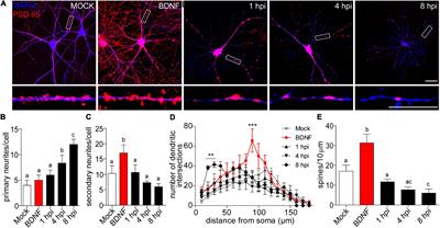 Herpes Simplex Virus Type 1 Neuronal Infection Triggers the Disassembly of Key Structural Components of Dendritic Spines